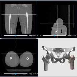 3d打印人体骨骼 这家哈佛大学孵化的公司要为中国医生开发自己的软件平台...